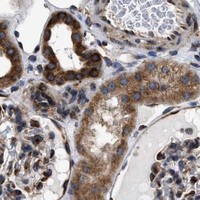 HPA IHC Kidney — KTN1