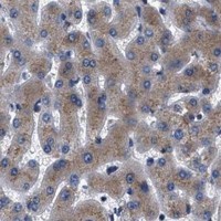 HPA IHC Liver — KTN1