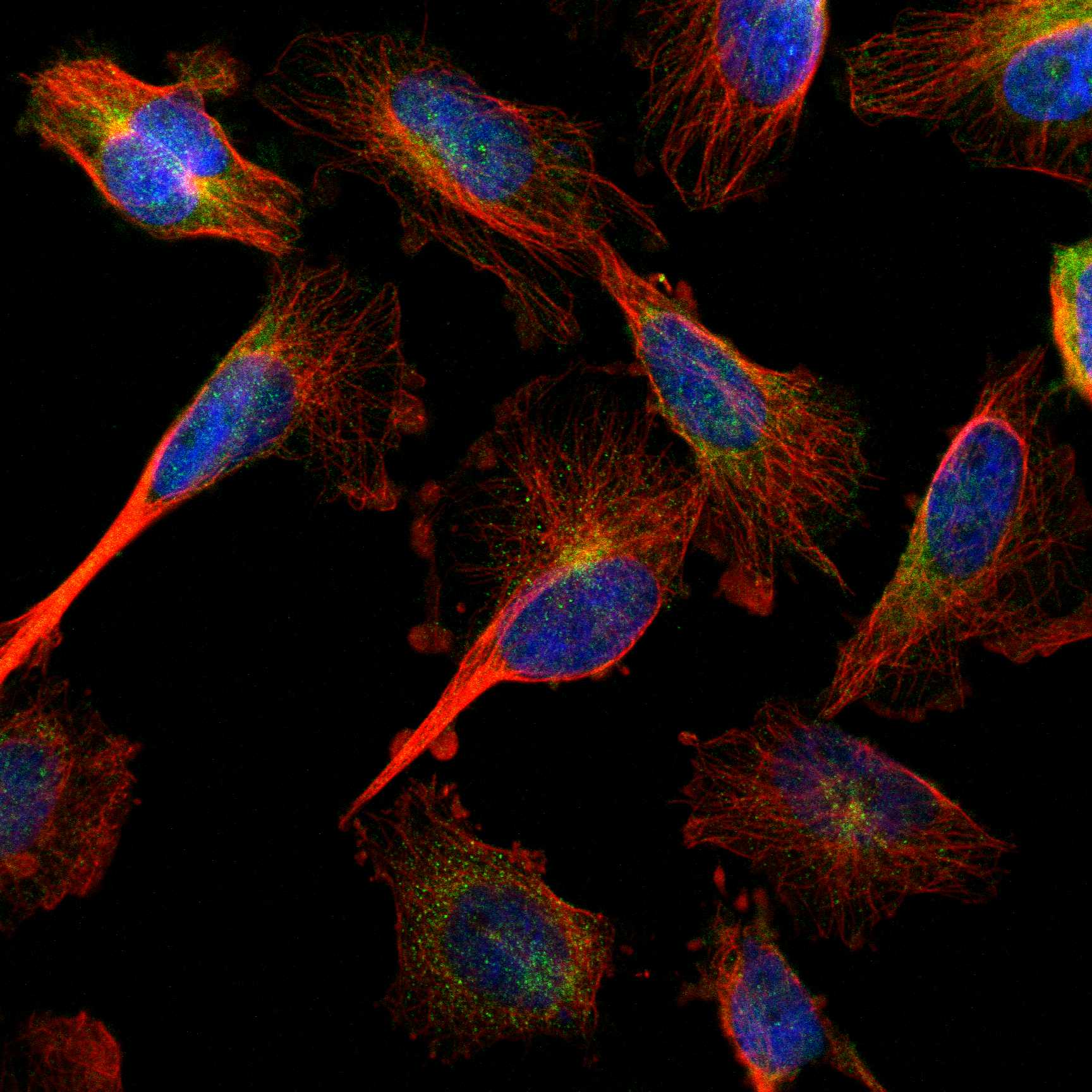 Cell atlas - AKR1A1 - The Human Protein Atlas