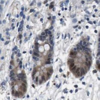 HPA IHC Colon — AKR1A1