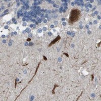HPA IHC Cerebellum — AKR1A1