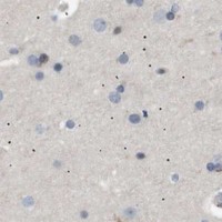 HPA IHC Cerebral cortex — AKR1A1