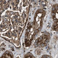 HPA IHC Kidney — MAP3K8