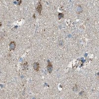 HPA IHC Cerebral cortex — BCKDK