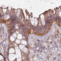 HPA IHC Colon — SAV1