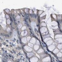 HPA IHC Colon — TTBK2