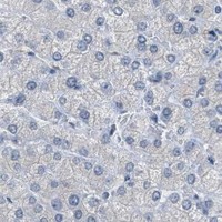 HPA IHC Liver — TTBK2