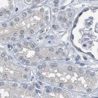 HPA IHC Kidney — TTBK2