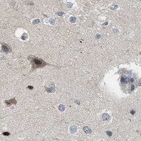 HPA IHC Cerebral cortex — TTBK2