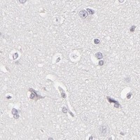 HPA IHC Cerebral cortex — APOBEC3G