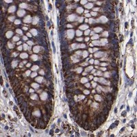 HPA IHC Colon — SOD2