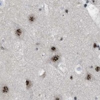 HPA IHC Cerebral cortex — CDR2