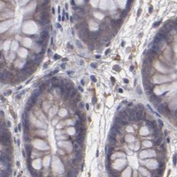 HPA IHC Colon — ITGB5