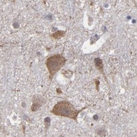 HPA IHC Cerebral cortex — ITGB5