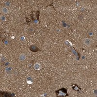 HPA IHC Cerebral cortex — PFKP