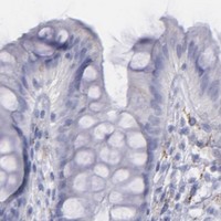 HPA IHC Colon — SNAP25