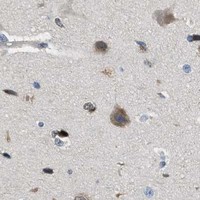 HPA IHC Cerebral cortex — TOX