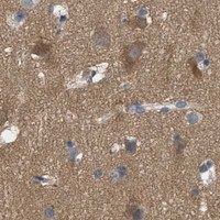 HPA IHC Cerebral cortex — ADCY6