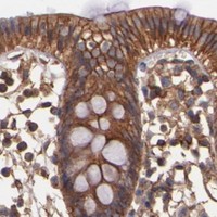 HPA IHC Colon — TMOD3