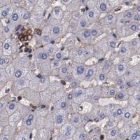 HPA IHC Liver — TMOD3