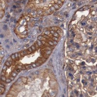 HPA IHC Kidney — TMOD3