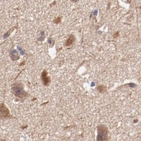 HPA IHC Cerebral cortex — TMOD3