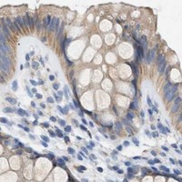 HPA IHC Colon — NDUFS8