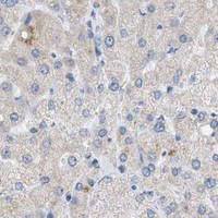 HPA IHC Liver — NDUFS8