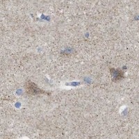HPA IHC Cerebral cortex — NDUFS8