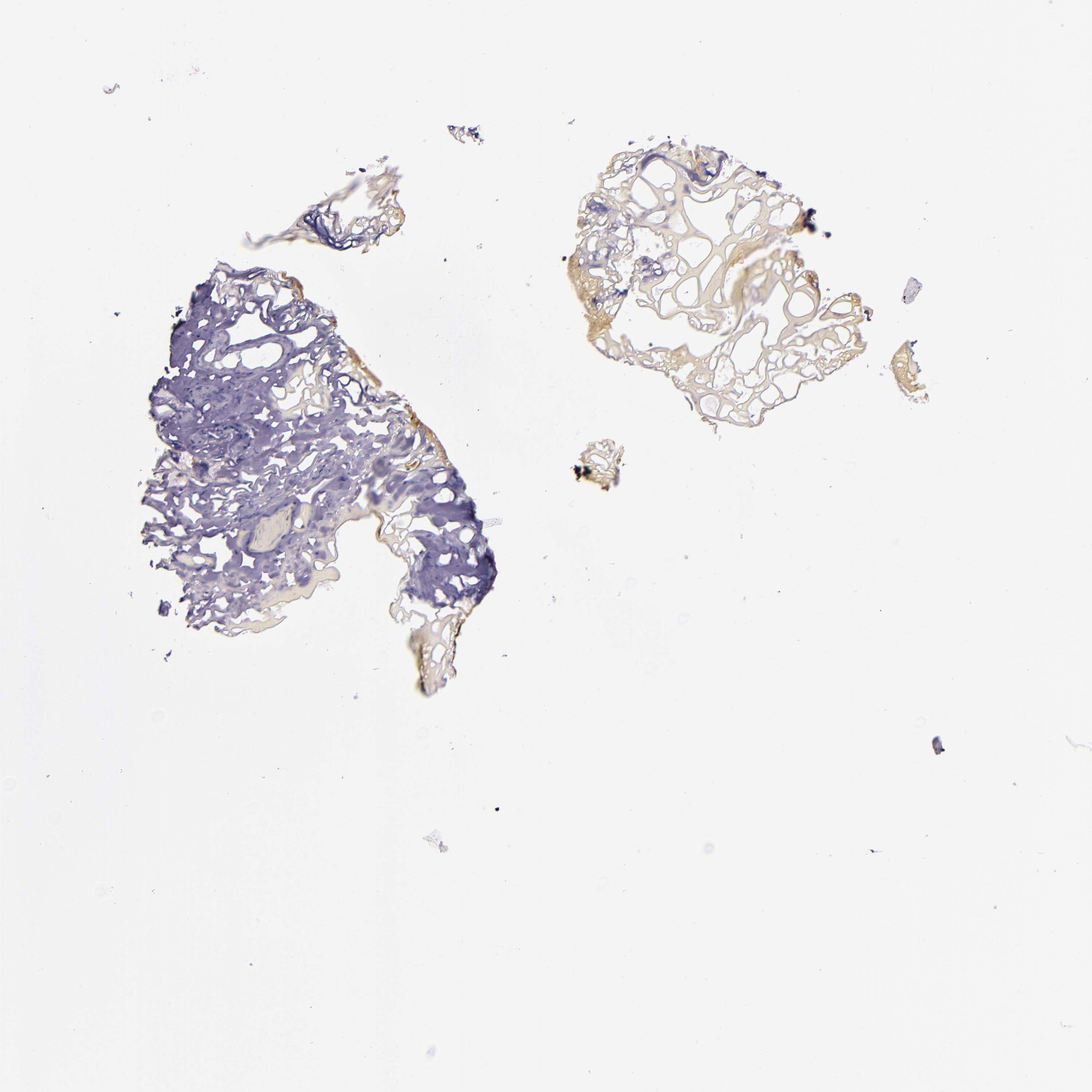 Tissue expression of STAT6 Staining in skin The Human Protein Atlas