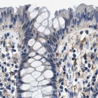 HPA IHC Colon — LRP1