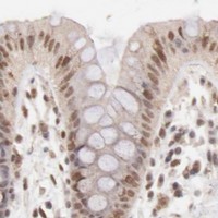 HPA IHC Colon — CLOCK
