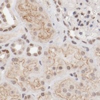 HPA IHC Kidney — CLOCK