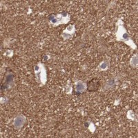 HPA IHC Cerebral cortex — FAT1