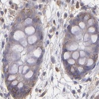 HPA IHC Colon — FAT1