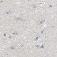 HPA IHC Cerebral cortex — ANAPC2