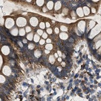 HPA IHC Small intestine — PRKG2