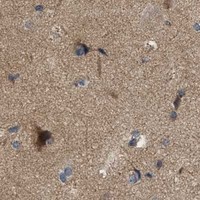 HPA IHC Cerebral cortex — PRKG2