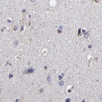 HPA IHC Cerebral cortex — ODF2
