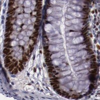 HPA IHC Colon — CHEK2
