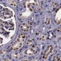 HPA IHC Kidney — CHEK2