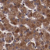 HPA IHC Liver — CHEK2