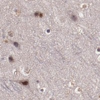 HPA IHC Cerebral cortex — CHEK2