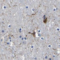 HPA IHC Cerebral cortex — PDLIM7