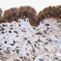 HPA IHC Gallbladder — LIF