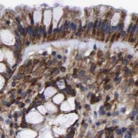 HPA IHC Colon — LIF