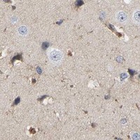 HPA IHC Cerebral cortex — LIF
