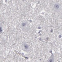 HPA IHC Cerebral cortex — LRG1