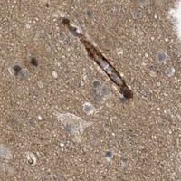 HPA IHC Cerebral cortex — EDNRA