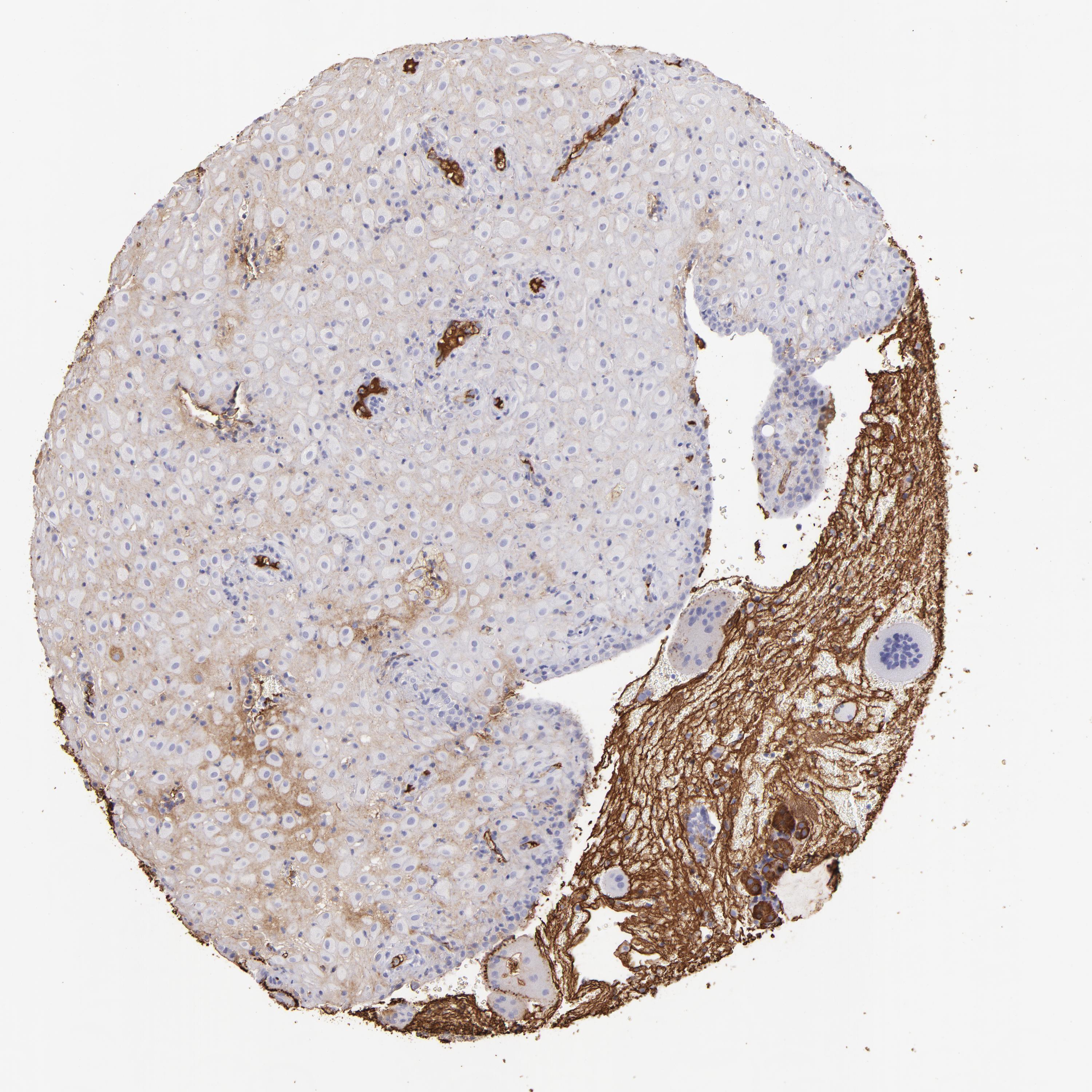 Tissue expression of FGB - Staining in placenta - The Human